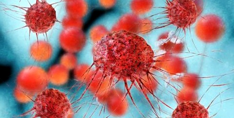 Mit Schallwellen lassen sich kranke Tumorzellen aus gesunden Blutzellen herausfiltern