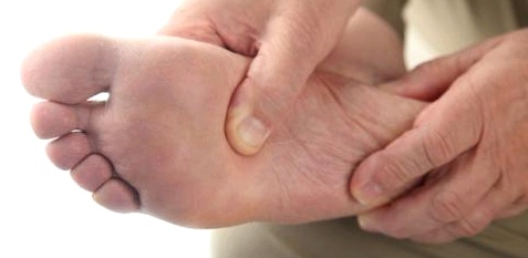 Bei einem diabetischen Fuß heilen kleine Wunden schlecht 
