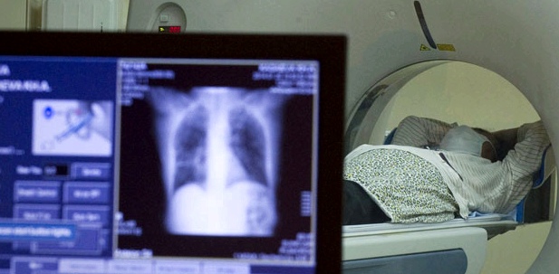 Eine Kernspintomografie verrät, ob sich der Herzmuskel entzündet hat