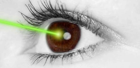 Laser korrigiert die Augenhornhaut