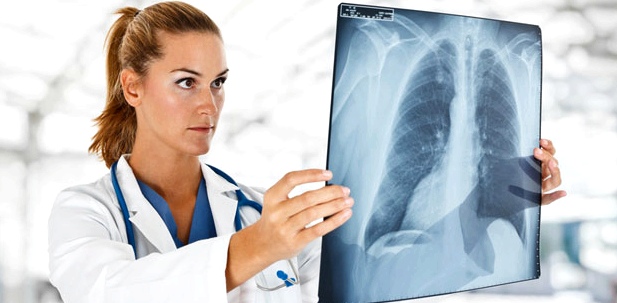 Röntgenbild der Lunge hilft bei der Bronchitis-Diagnose