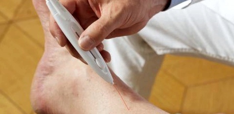 Bei Sensibilitätsstörungen in den Beinen feststellen, sollten Sie umgehend Arzt aufsuchen